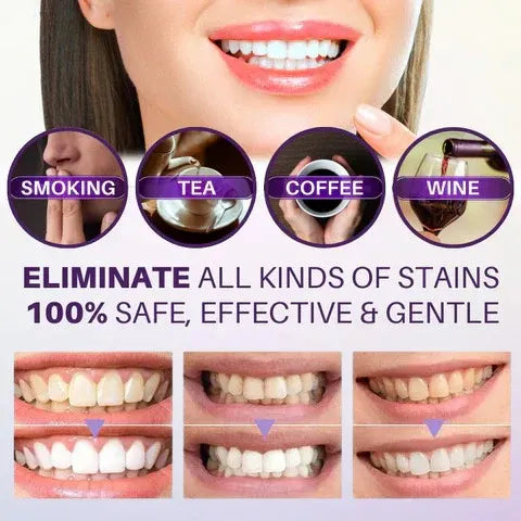 Hismile v34 Color Corrector Serum - Instant Teeth Whitening